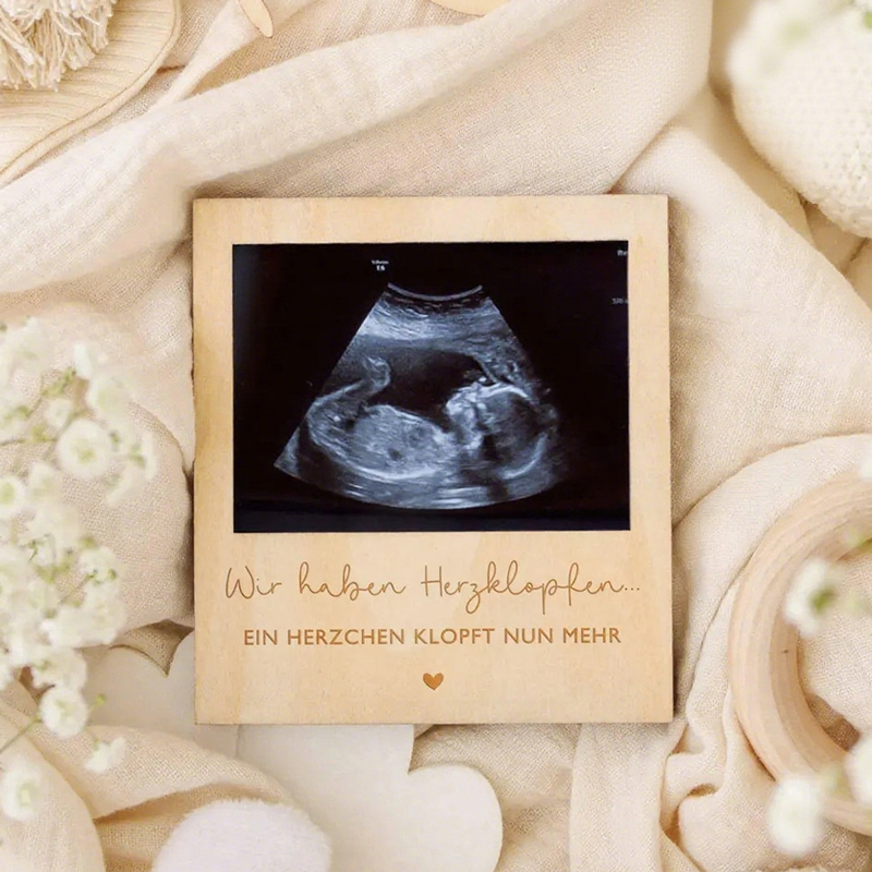 Ultrasound Pregnancy Announcem - Photo Booth Frame 评论和价格