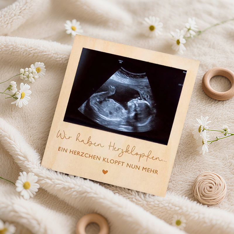 Ultrasound Pregnancy Announcem - Photo Booth Frame 评论和价格